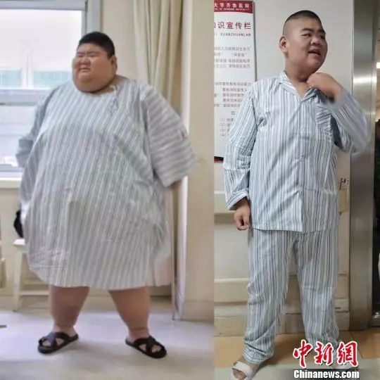 胖子都是潜力股!一年减重400斤,他是怎么做到的?