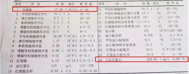 细菌感染or病毒感染早分