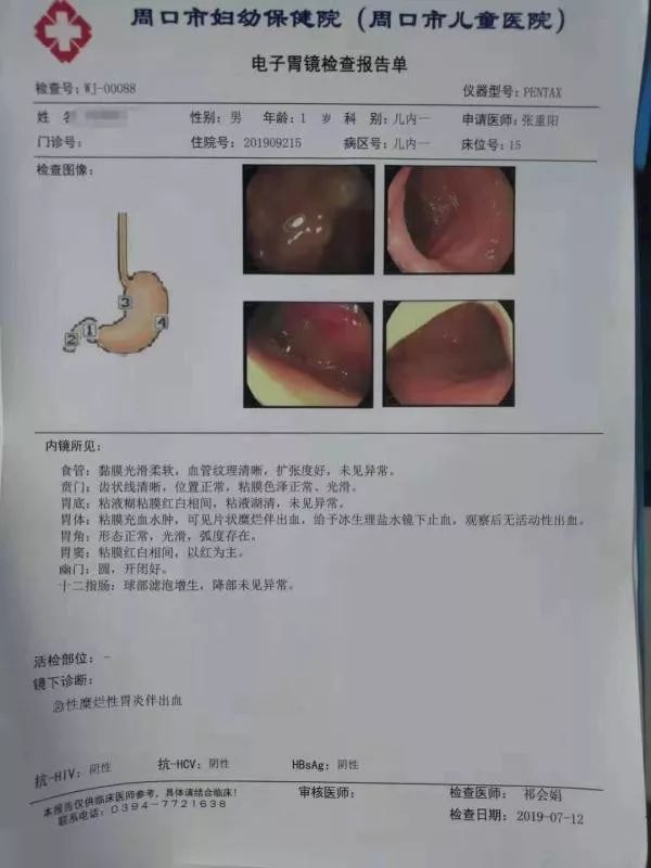 面色及口唇发绀,患儿经绿色通道急诊住院,初步诊断为急性糜烂性胃炎伴