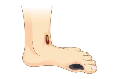 脚背疼是什么因素导致,护理脚背日常做法有哪些