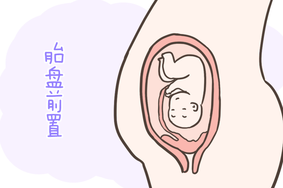 怀孕后,胎盘前壁和后壁有什么区别?这个位置很危险,孕