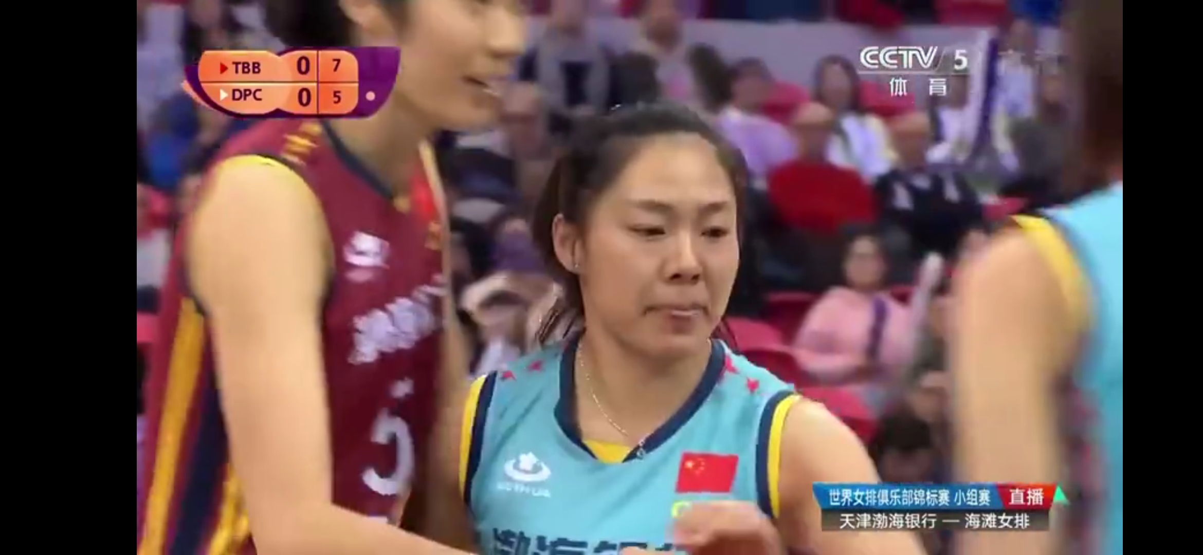 心疼!天津女排自由人刘立雯左眼直接被扣肿