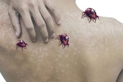 螨虫过敏导致皮肤发痒,3种除螨方法,懂得使用