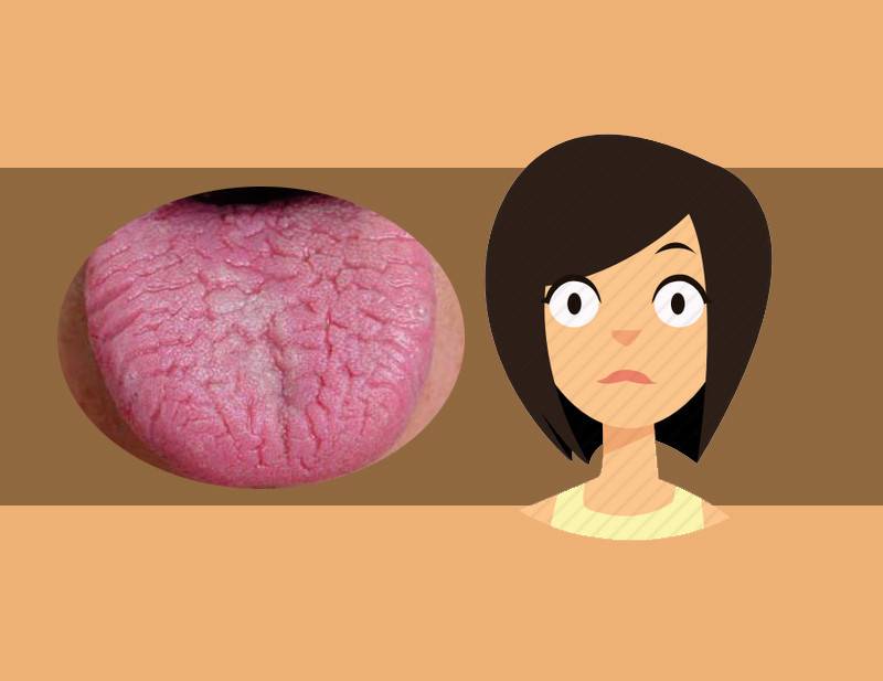 舌头发紫暗示血液有病7种舌头异常的含义早做了解