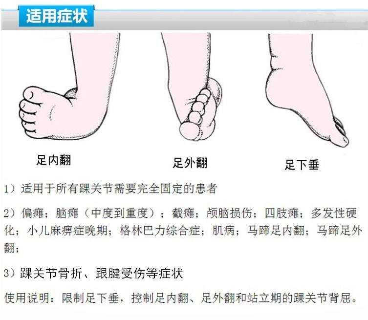 医生建议这5类鞋别给宝宝穿,容易造成宝宝脚畸形,快看