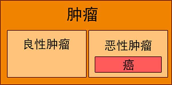 什么是癌症肿瘤和肿块懂点医学知识无论男女老少都应该