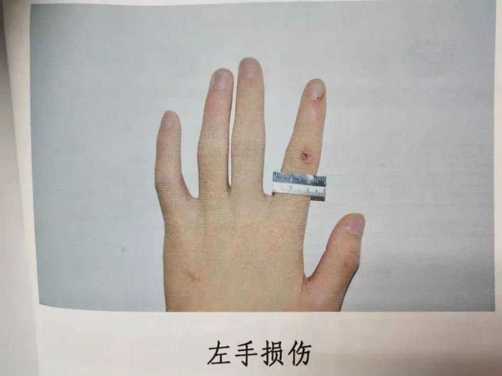 经法医鉴定,民警不构成轻微伤,保安构成轻微伤.