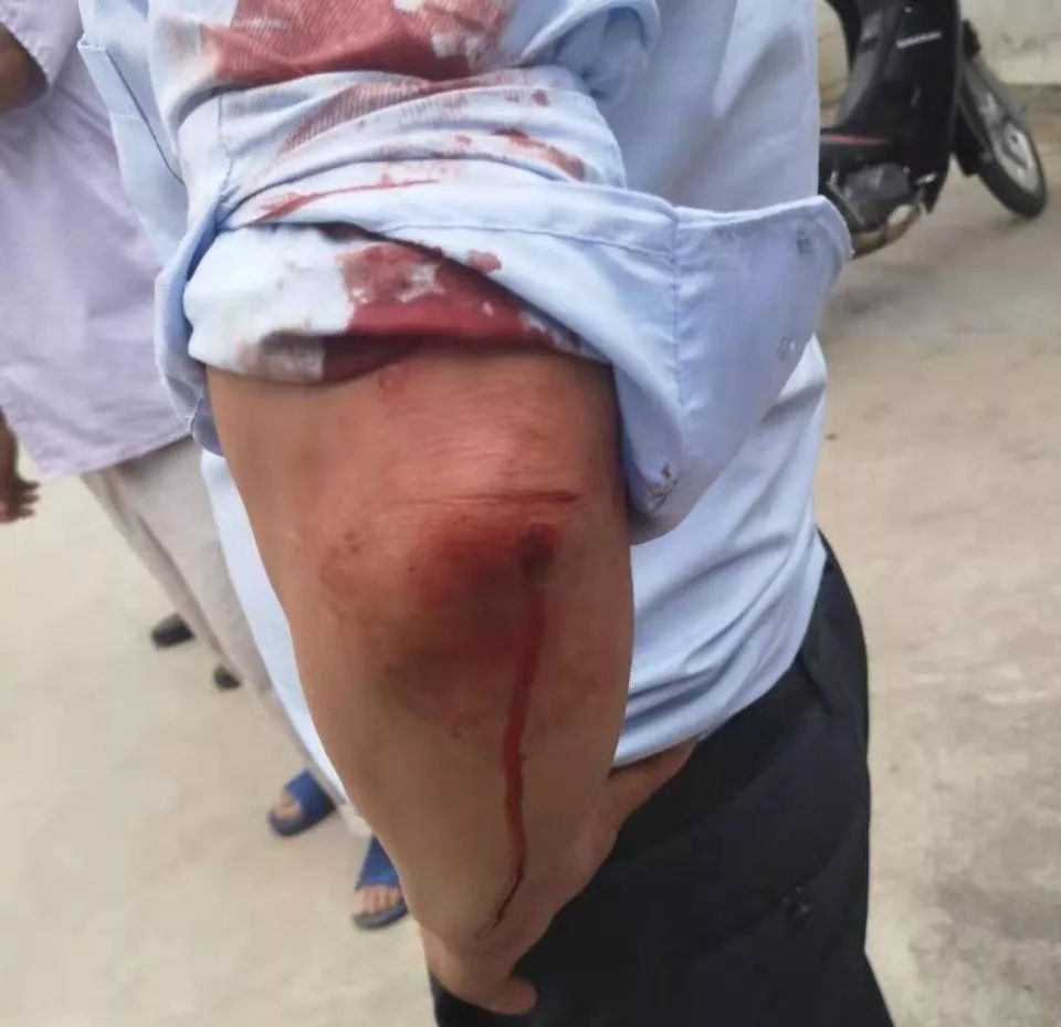 月9日16时许,石婆店派出所接到群众报警称在鲍冲村医疗室门口有人打架