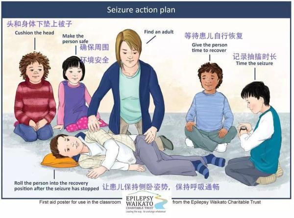 发热温度过高会引发热性惊厥发生热性惊厥之后的6步处理办法