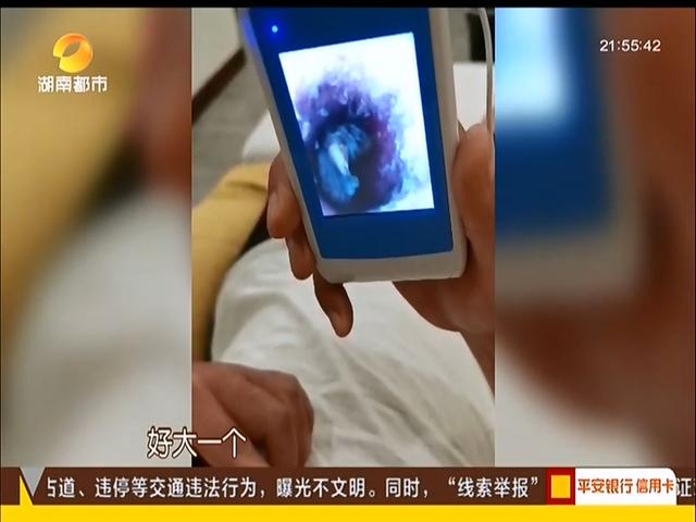 光明网■男子走在路上，忽然感觉耳朵一阵刺痛还嗡嗡响，随后取出一活物