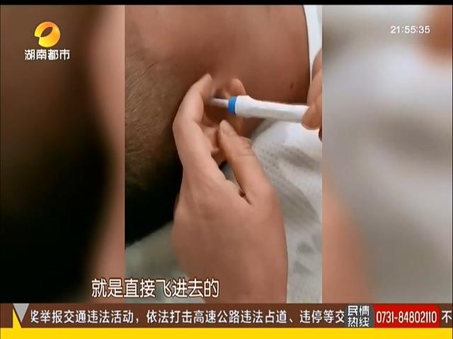 光明网■男子走在路上，忽然感觉耳朵一阵刺痛还嗡嗡响，随后取出一活物