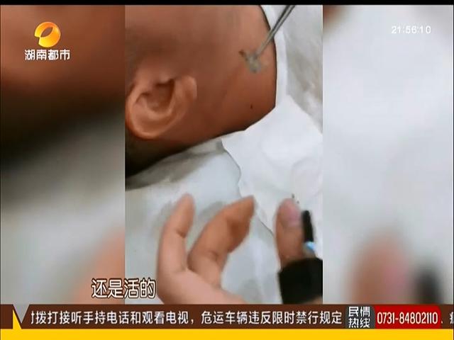 光明网■男子走在路上，忽然感觉耳朵一阵刺痛还嗡嗡响，随后取出一活物