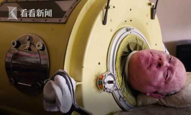 [看看新闻]男子6岁患病住“铁桶”67年？只剩头在外面 靠惊人毅力成为律师