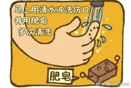 [光明网]狂犬病的潜伏期有多长？能够治愈吗？