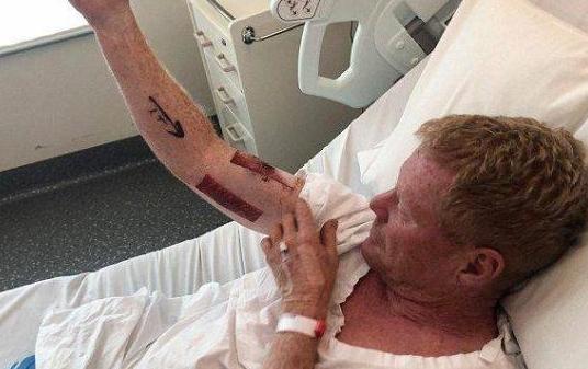 【光明网】美国男子海边冲浪，罕见遭鲨鱼撕咬，原因竟怪穿的衣服？