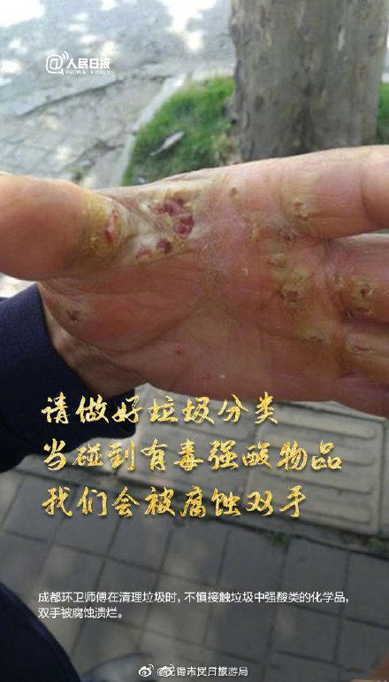 #光明网#一起为他们发条微博