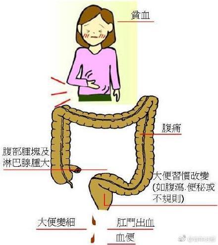 「光明网」28岁女设计师10个月来肚子隐隐作痛，一查竟是癌！都是工作害了她