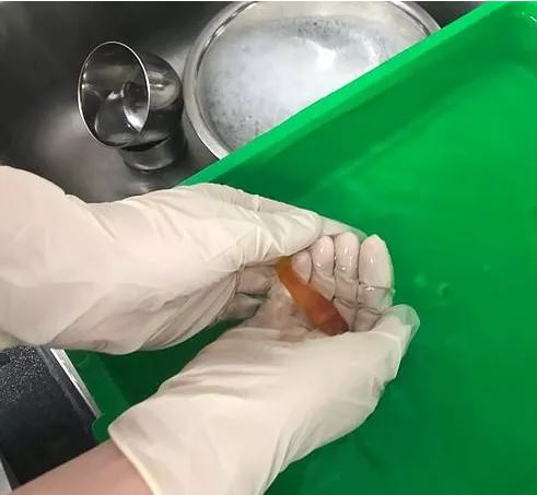 「文汇报」不到1克的超小金鱼长了肿瘤，医生居然成功做了切除手术