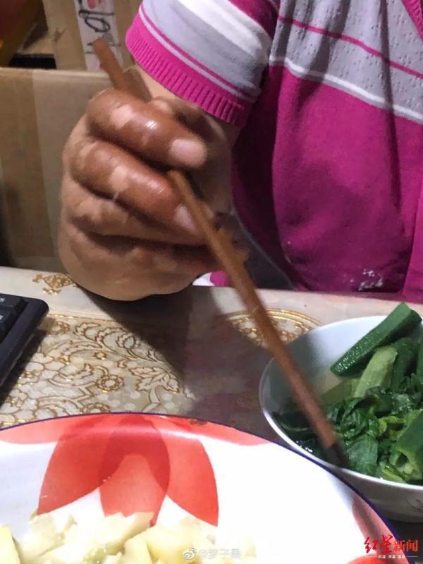 光明网■这种果子随处可见，但千万别吃！严重或致死