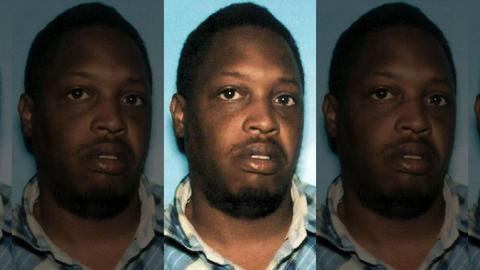 「海外网」美国女子遭枪击头骨卡子弹1月未察觉 医生：必须留里面