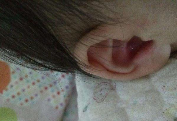 #光明网#孩子一直掏耳朵总说听不清，妈妈一看吓了一跳，检查后被医生责怪