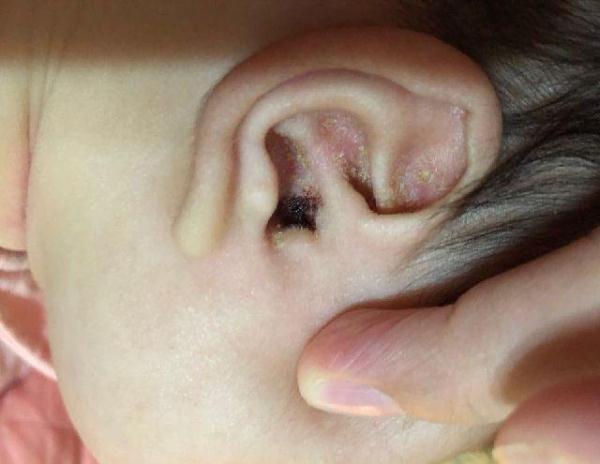 #光明网#孩子一直掏耳朵总说听不清，妈妈一看吓了一跳，检查后被医生责怪