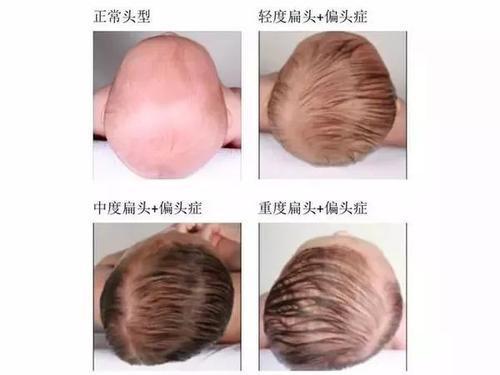 光明网■如何给宝宝睡出好看的头型？单靠睡姿可不够