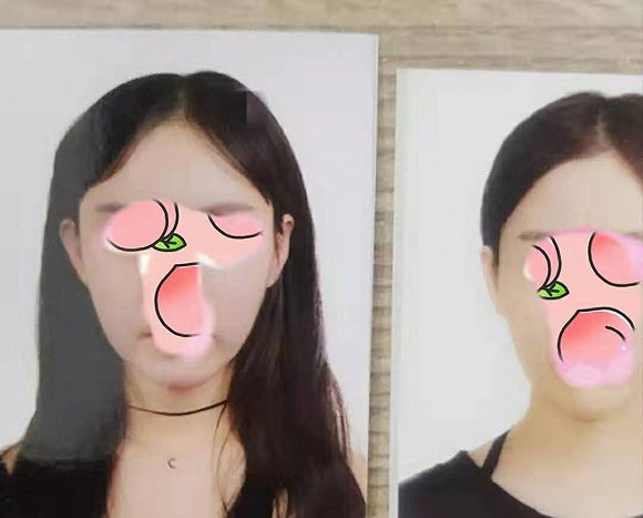 界面：中国女孩韩国整形失败 互联网医美平台要负多少责任