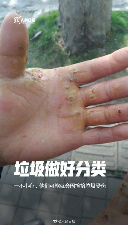 [光明网]今天，请为他们发条微博，帮环卫工人上热搜