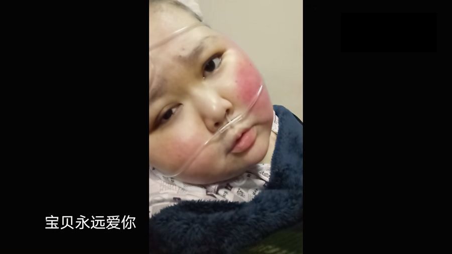 共青团中央：青听 | 患骨癌的安仔
