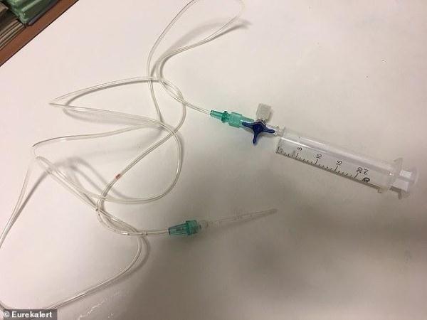 【光明网】熊孩子把舌头伸进玻璃瓶卡住拿不出来，医生受开葡萄酒启发取出