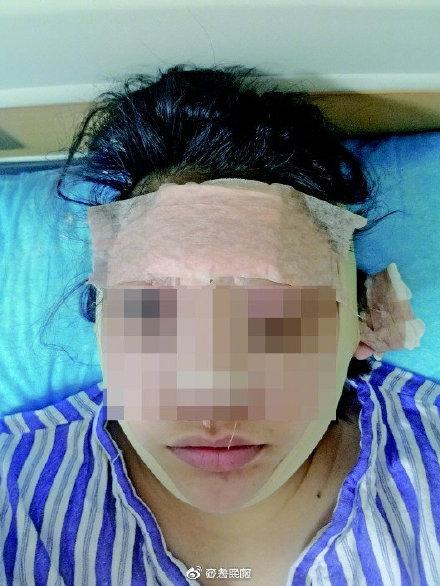 光明网■天上不会掉馅饼 贷款整容当网红陷圈套