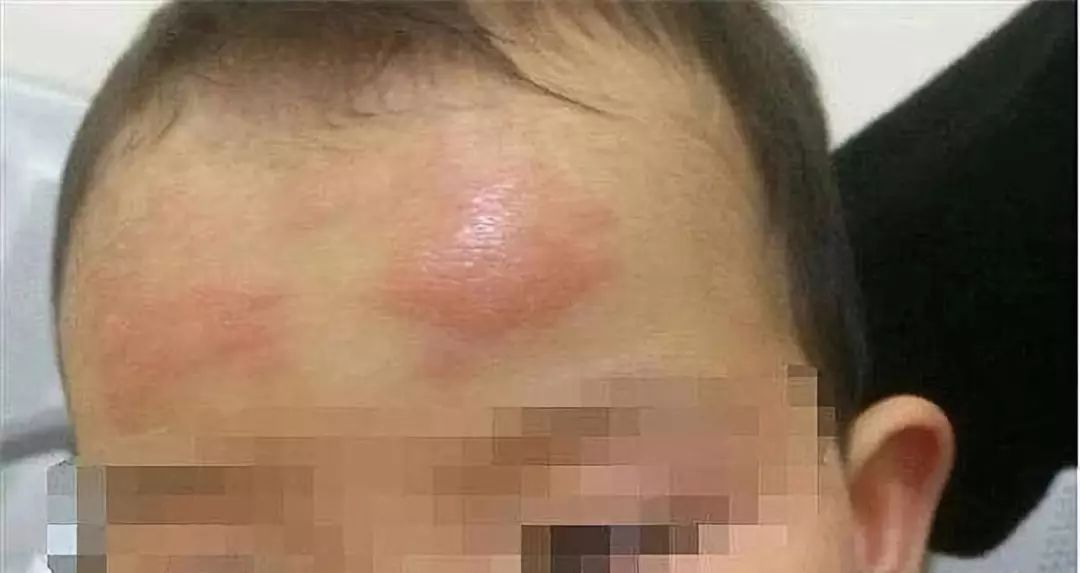 人民日报@【提醒】退热贴骗了多少中国父母！国内外指南从未承认过