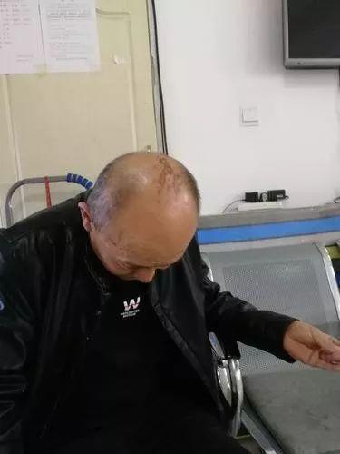 「环球网」八旬老人被困火海！61岁老人救人被砸伤：“有人就得救！”这不是他第一次救人