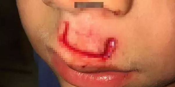 [中国教育报]这8种致命网红毒玩具，千万别给孩子买！快看看你家有吗 | 精选