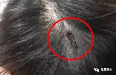 「光明网」在餐厅吃饭竟有老鼠掉头上！女子头皮瞬间被咬破，更惨的是……