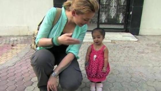 光明网@印度女子身高63cm，体重6公斤，打破纪录成世界上最矮的女子