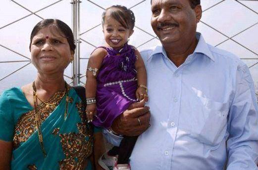 光明网@印度女子身高63cm，体重6公斤，打破纪录成世界上最矮的女子