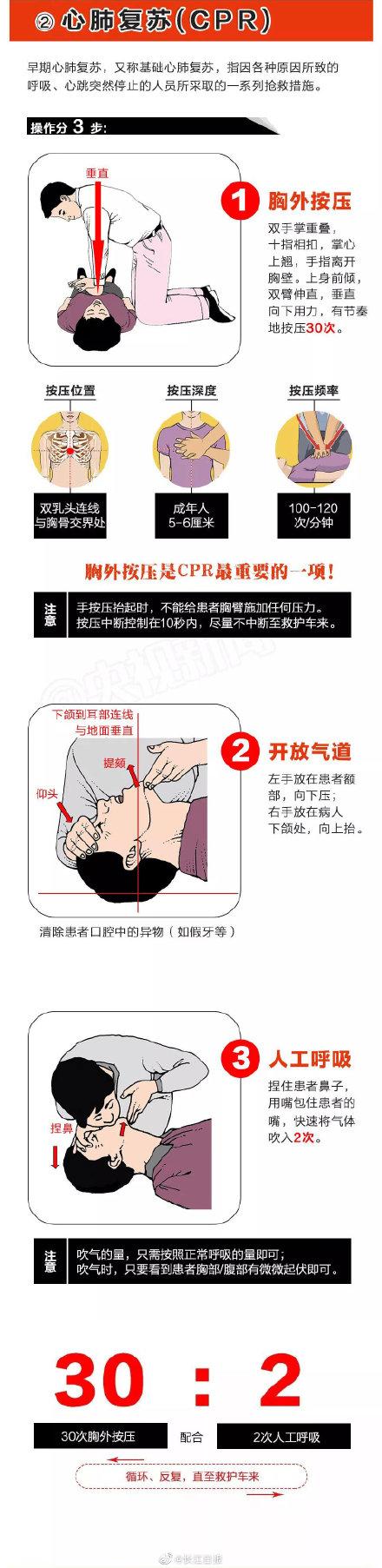 【光明网】这个救命方法你一定要学会