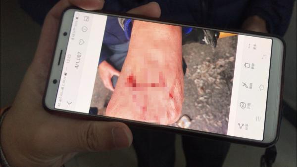 [中国经济网]业委会主任被78岁业主薅下了一把头发，理由竟是不让他们在门口“晒太阳”