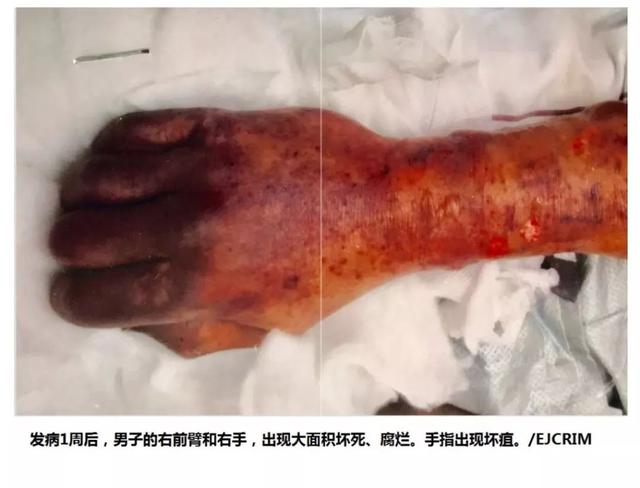 「中国经济网」死亡之吻？被爱犬舔了下，去世！不是因为狂犬病……