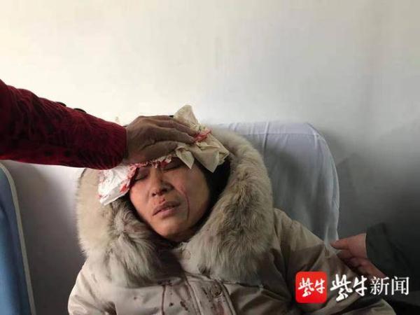 「光明网」1米8高路牌突然砸来，她迎了上去……不能躲，她只能满头是血拼命托着路牌，因为身后有一群孩子