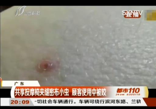 光明网：男子做按摩时感觉大腿发痒 拉开裤子一看 简直不堪直视