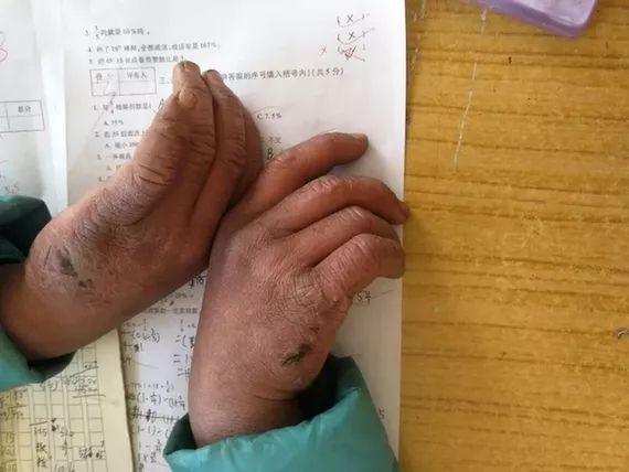 「中国经济网」两年后记者再次实地探访“冰花男孩”他现在情况如何呢？