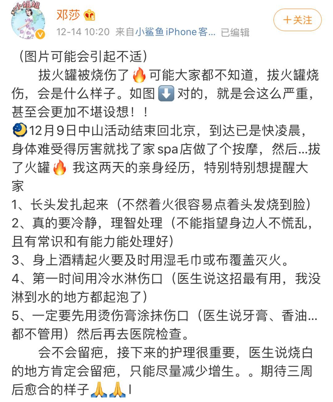 环球网@女演员曝拔火罐被深度烧伤，没想到如此严重！