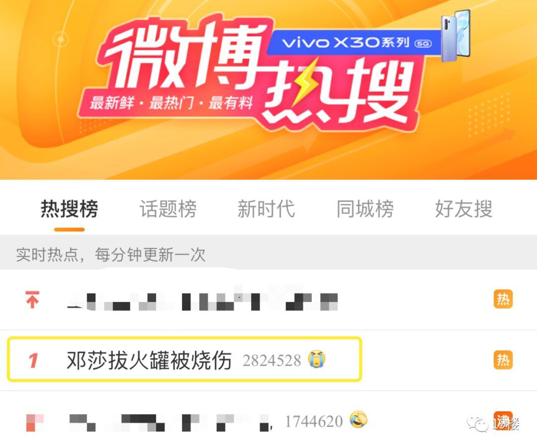 环球网@女演员曝拔火罐被深度烧伤，没想到如此严重！