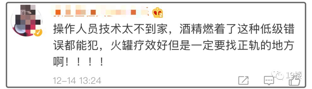 环球网@女演员曝拔火罐被深度烧伤，没想到如此严重！