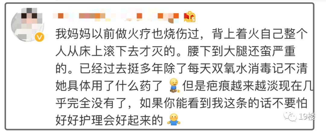 环球网@女演员曝拔火罐被深度烧伤，没想到如此严重！