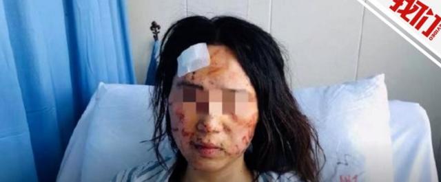新京报■女子遭当街暴打毁容涂大便，别拿所谓的“内情”为家暴洗白
