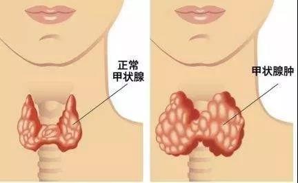 文汇报@体检查出这10种病基本不用治，千万别自己吓自己！请把医生的忠告转给所有人！